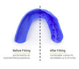 Sisu 3D Custom Fit Youth Mouth Guard